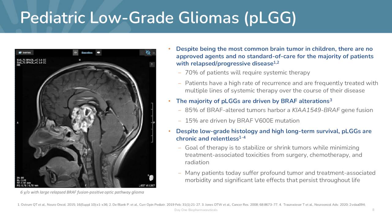 Pediatric Low-Grade Gliomas (pLGG)