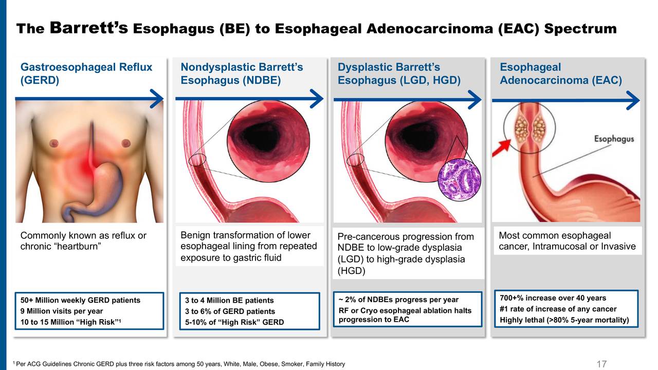 PAVmed (PAVM) Presents At Cantor Fitzgerald Virtual Global Healthcare Conference Slideshow