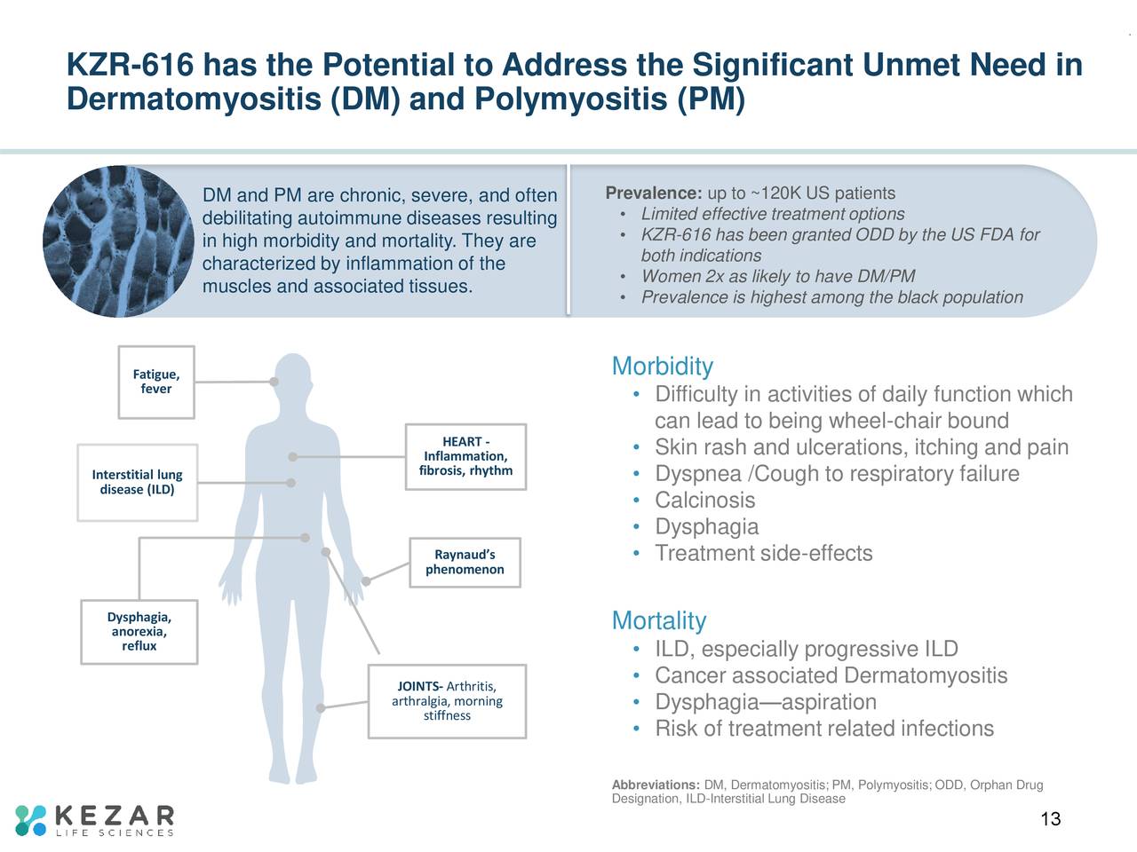 KZR-616 has the Potential to Address the Significant Unmet Need in