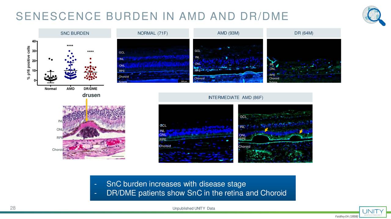 SENESCENCE BURDEN IN AMD AND DR/DME