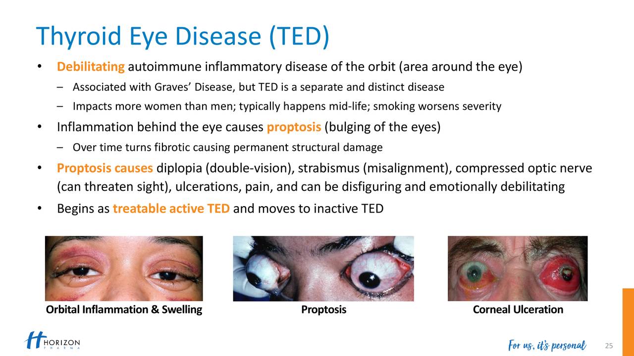 Thyroid Eye Disease (TED)